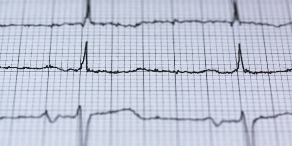 ECG heart rate monitor reading pulse anxiety heart rate